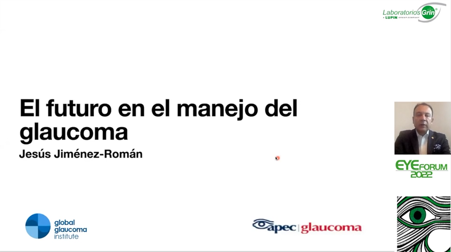 El futuro en el manejo del Glaucoma