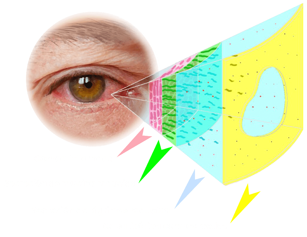 Image link