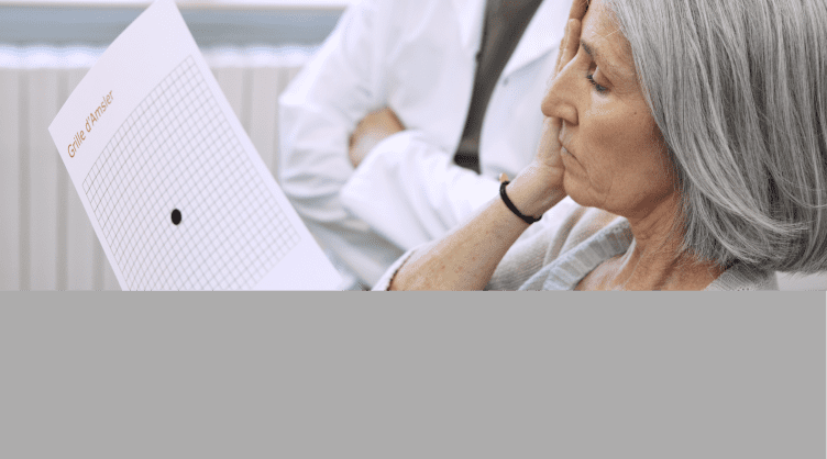 Degeneración macular relacionada con disbiosis intestinal