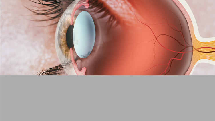 Klotho, la proteína involucrada en el desarrollo de retinopatía diabética. 