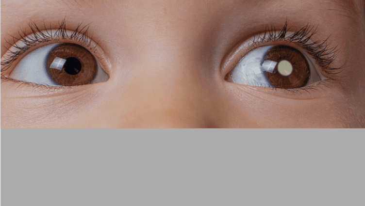 Visión y retinoblastoma