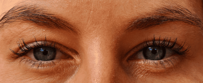 Omega -3 como tratamiento complementario ojo seco